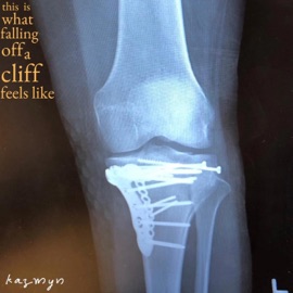 This Is What Falling Off a Cliff Feels Like Kazmyn