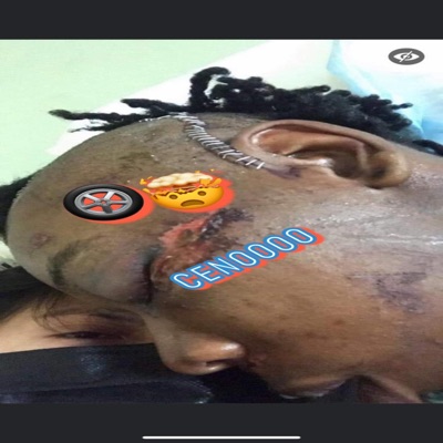 (Tirehead) Cenoosyndrome - Single