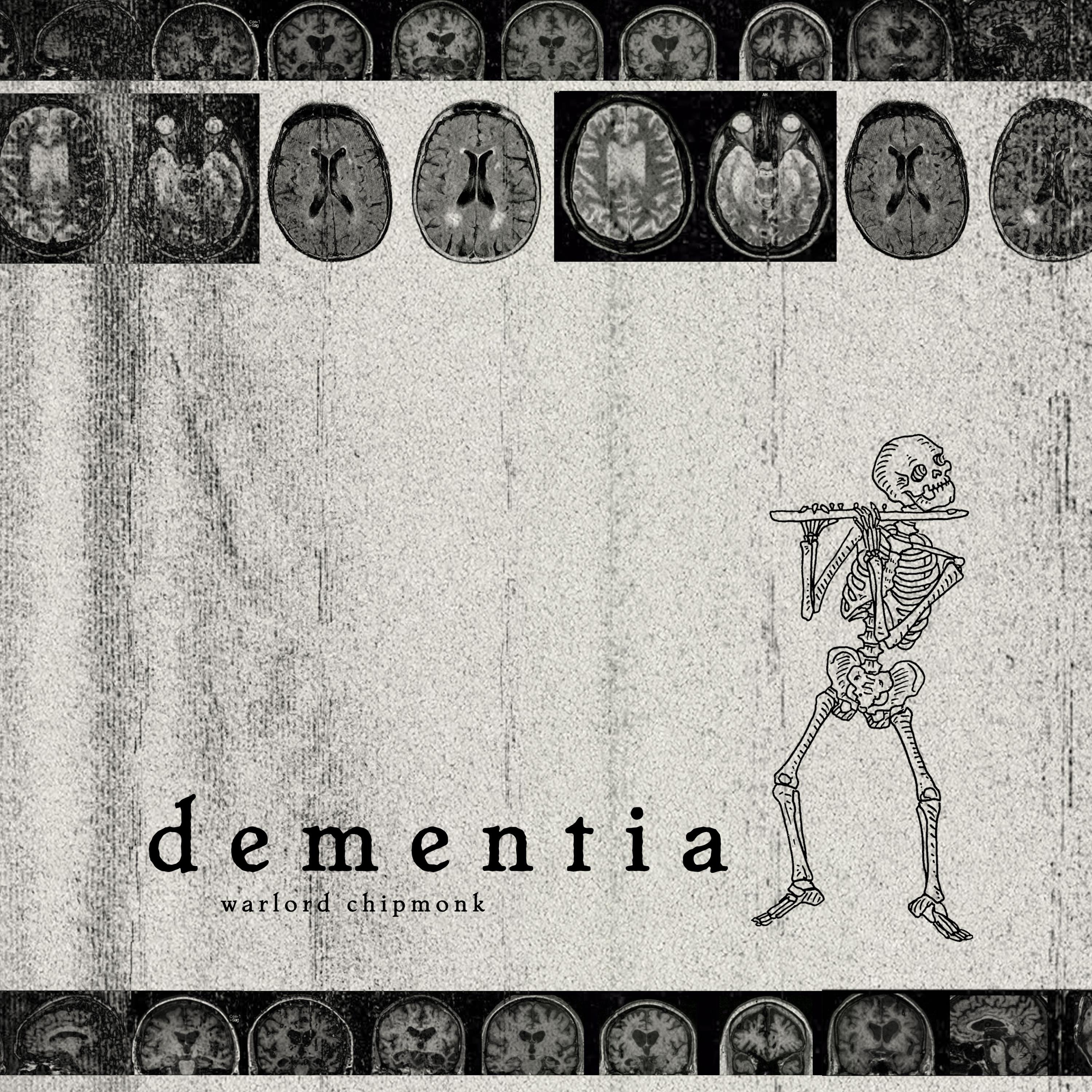 Dementia