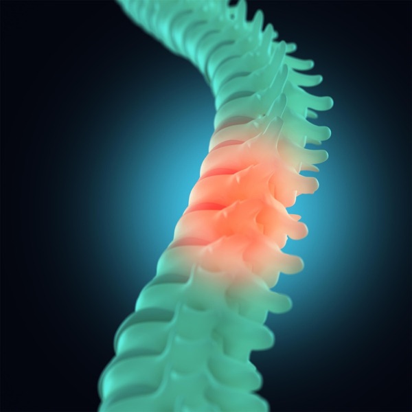 Slipped Disc - EP