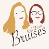 Bruises