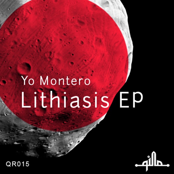 Lithiasis - Single