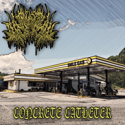 Concrete Catheter - Single