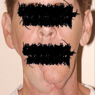 grotesque facial reconstruction - Single