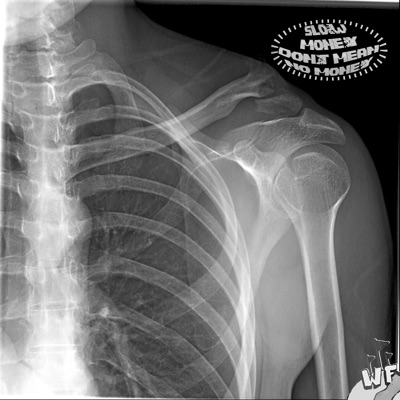 Slow money don't mean no money - EP