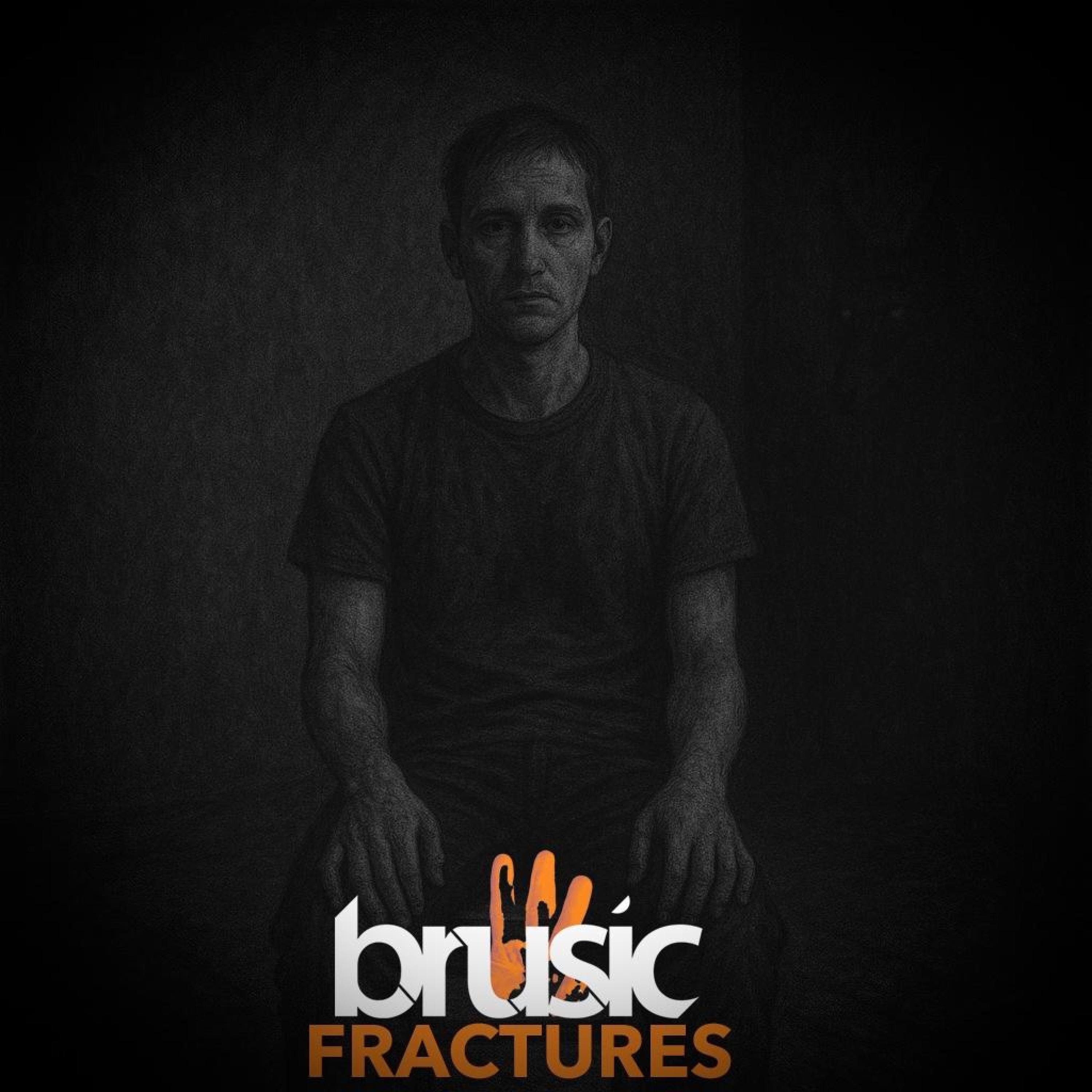 Fractures - Single