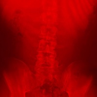 + Surviving 2 Live + - Death Don Furcon