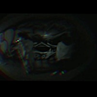 kick ha outt (feat. Yvxngski) - Single - deadboylo