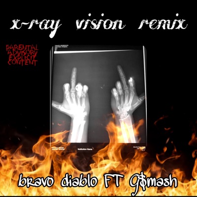 X-Ray Vision (Remix) [feat. GSBAMM] - Single