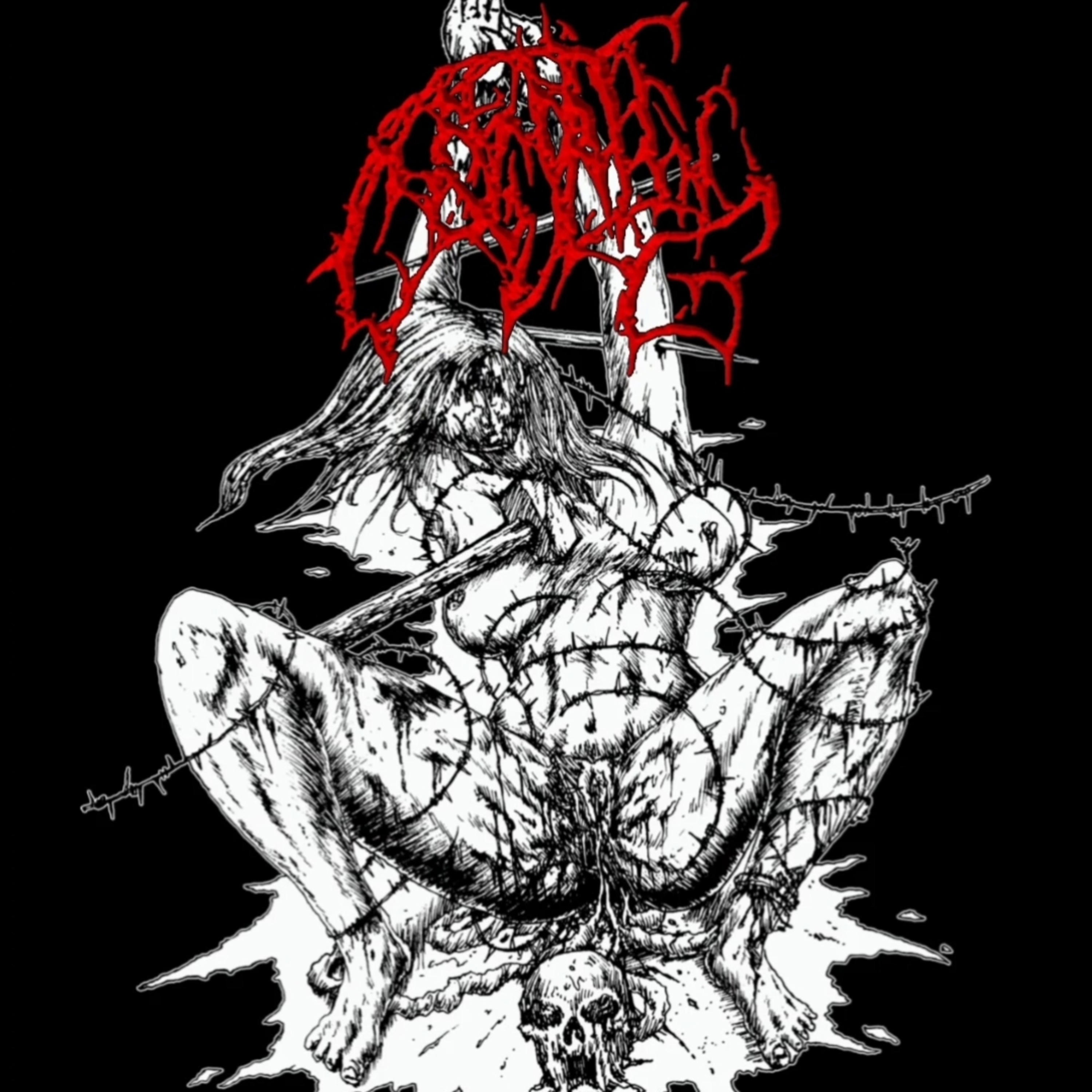 Spiraling Induced Barbedwire Lacerations - Single