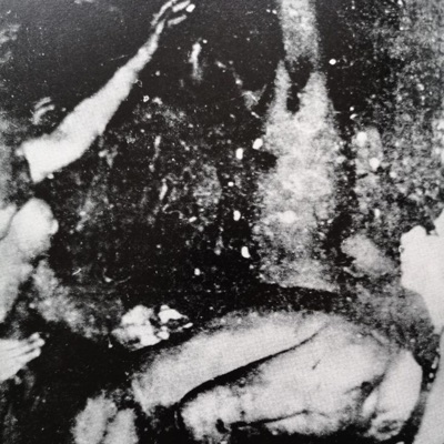 surgicalmovement - Single