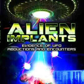 Alien Implants: Evidence of UFO Abductions and Encounters