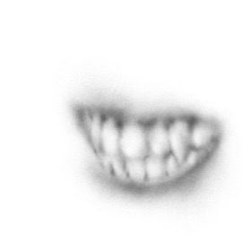 Neimans (Cresta) plegism