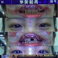 404 Mixtape - EP - Adisxn