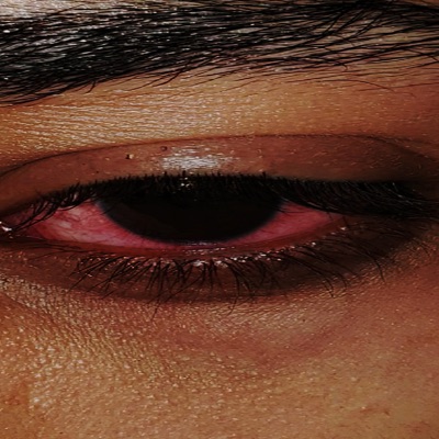 Ojos Rojos - Single