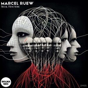 Skull Fracture - Single