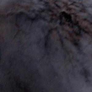 scars