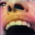 Desgaste