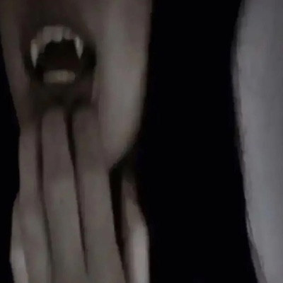 scars on my arms - Single