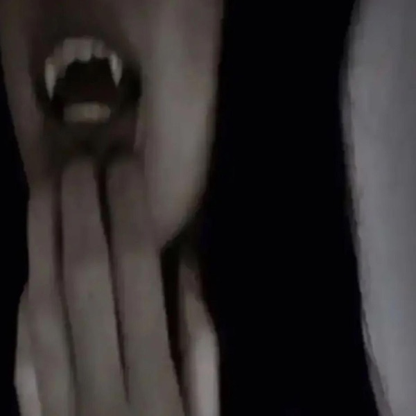 scars on my arms