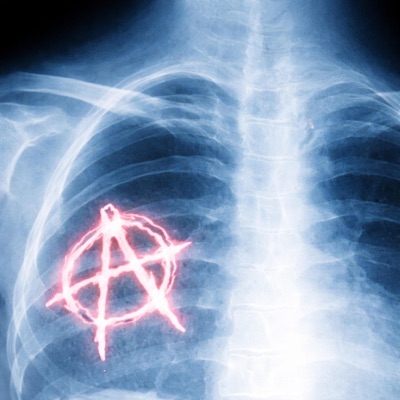 X-ray - Single