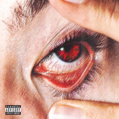 ##matabengkak - Single