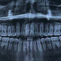 Riot - Single - FRANTIC