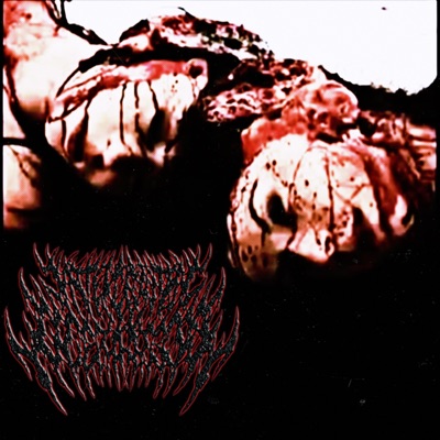 Intercranial Laceration - EP