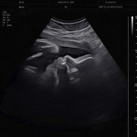 Dimenticare il tuo nome