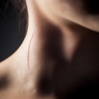 Ten Unutmuyor (Akustik) [feat. Efe Demiral, Ediz Hafızoğlu & Orhan Deniz] - Single - Taner Sarf