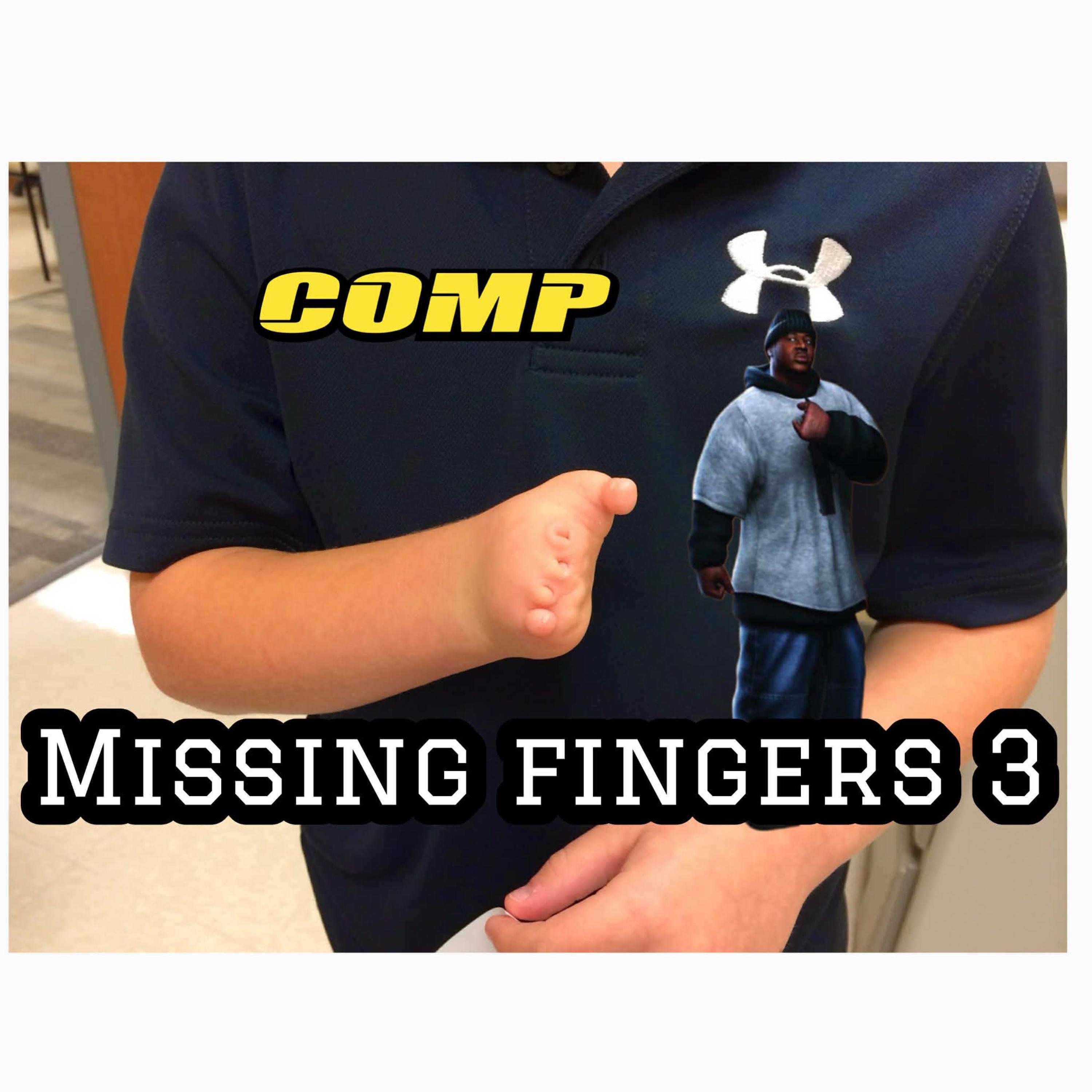 missing fingers 3