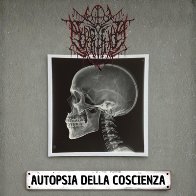 Autopsia della coscienza - Single