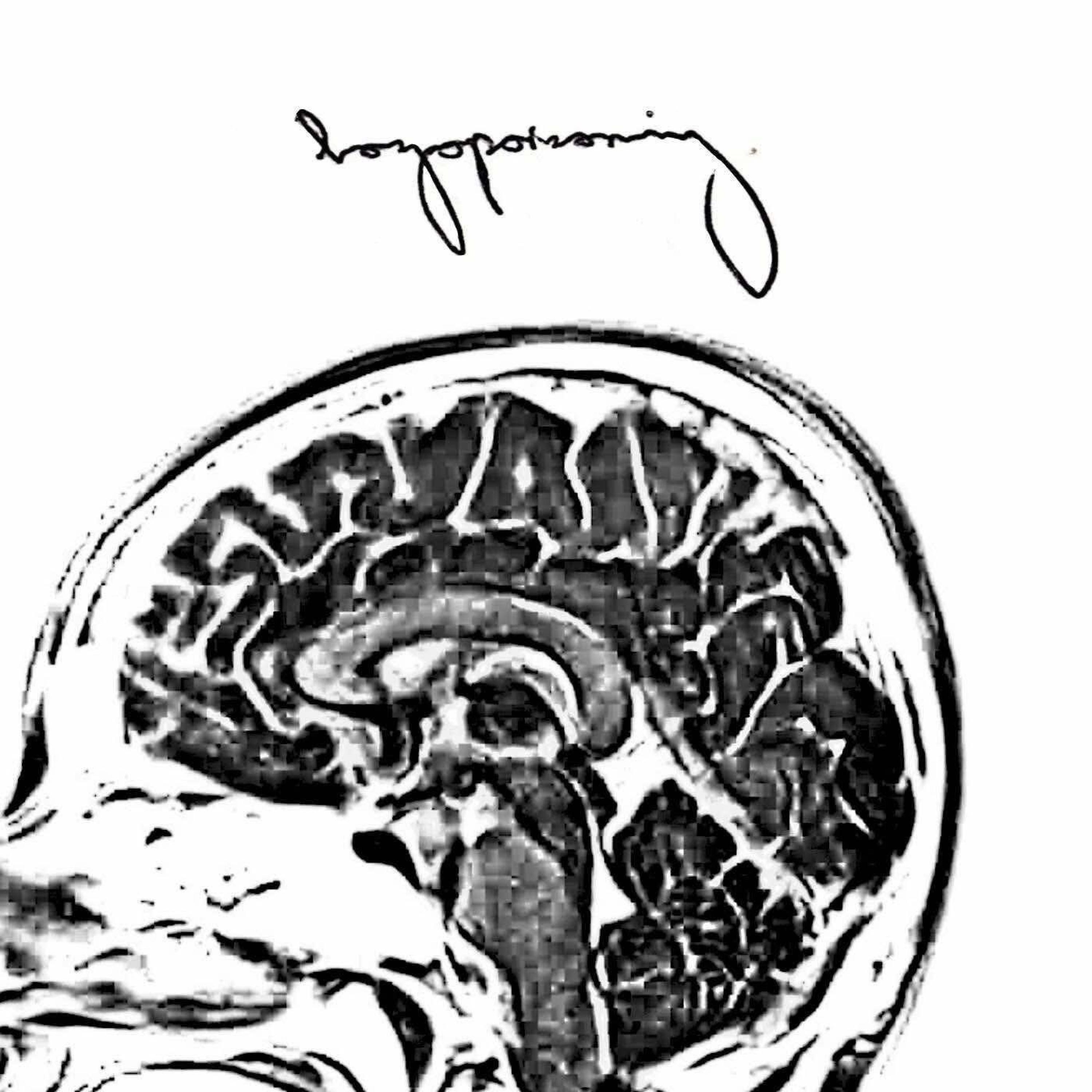 Boyopoisoning - EP