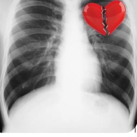 Xeven (Replace me) Simpkin