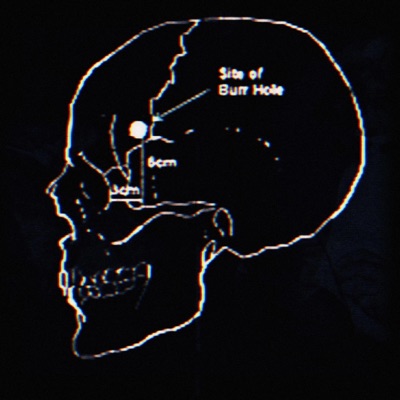 Complexul de superioritate - EP