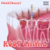 Root Canal - Single