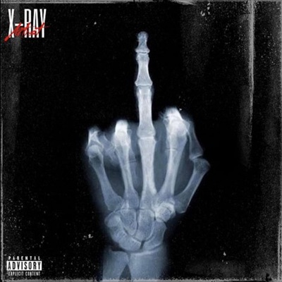 X-Ray - Single