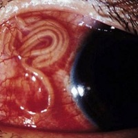 ParasiteEVE (feat. Vital $ignz & Blokka $oLO) - Single - Sid White