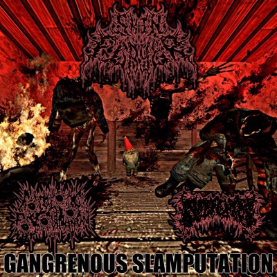 Gangrenous Slamputation - Single