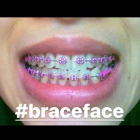 #Braceface - Single - smcukers
