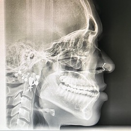 2dey (feat. Jxted) Trapp XL