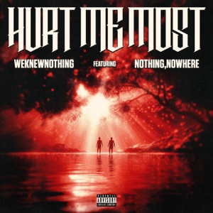 Hurt Me Most - EP