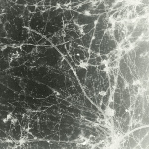Cold Euphoria - Single
