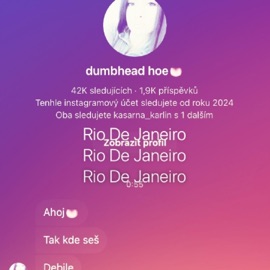 DUMBHEADHOE gadzotrendi