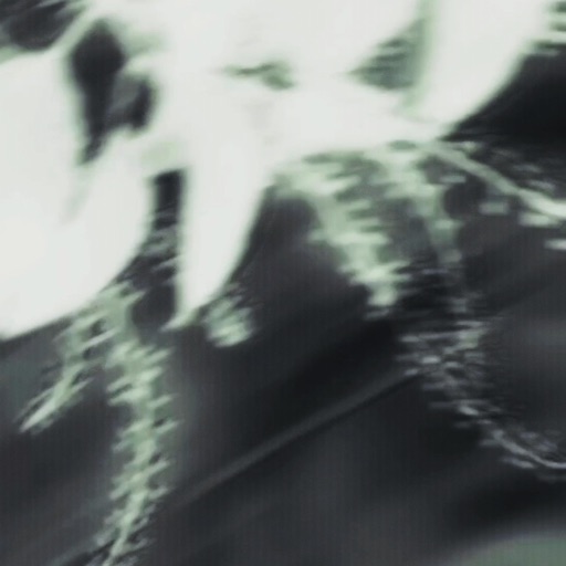 Album artwork