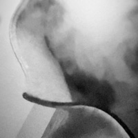 wym (feat. 6klled & kidracks) - Single - ionshopatsaks exclusives