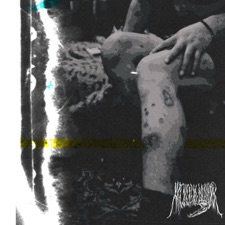 Dr. Freeze's Denied Health Healthcare Claim