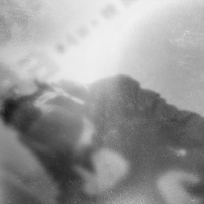 Asthma 2025 - Single