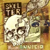 Skelter