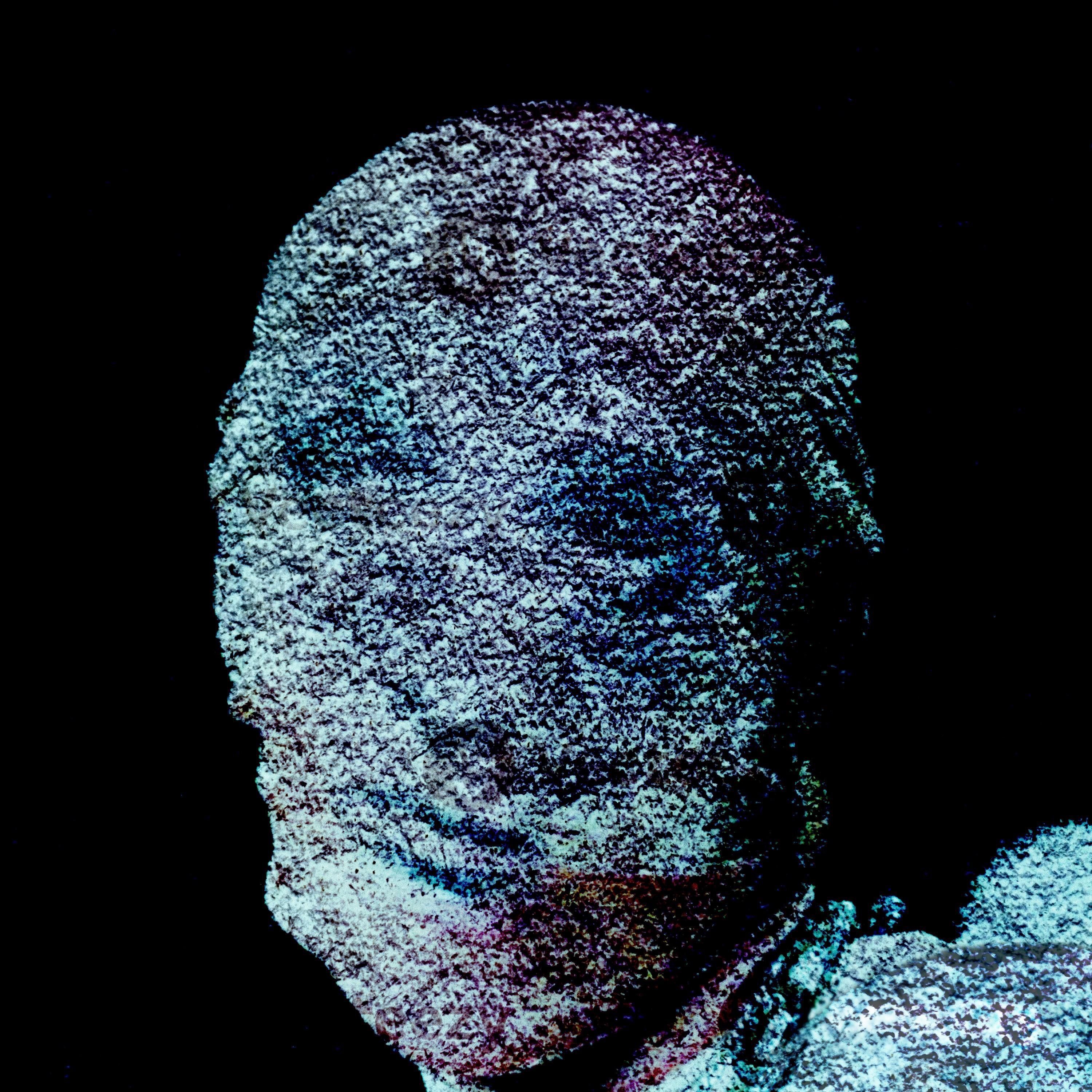 cyanosis